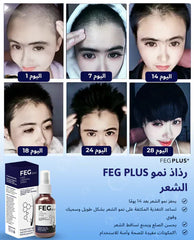 FEG Plus Hair Growth Spray+Japanes Sakura Shampoo