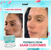 SAAM Renewal Face Cream | Melasma, Freckles, Age Spots & Dark Spots