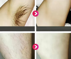 IPL Laser Hair Removal Device تقييم الثقة 4.9 | أكثر من 1,756 مراجعة