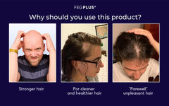 FEG Plus Hair Growth Spray+Japanes Sakura Shampoo