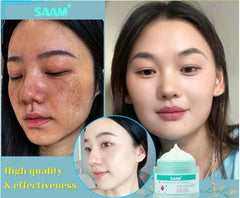 SAAM Renewal Face Cream | Melasma, Freckles, Age Spots & Dark Spots